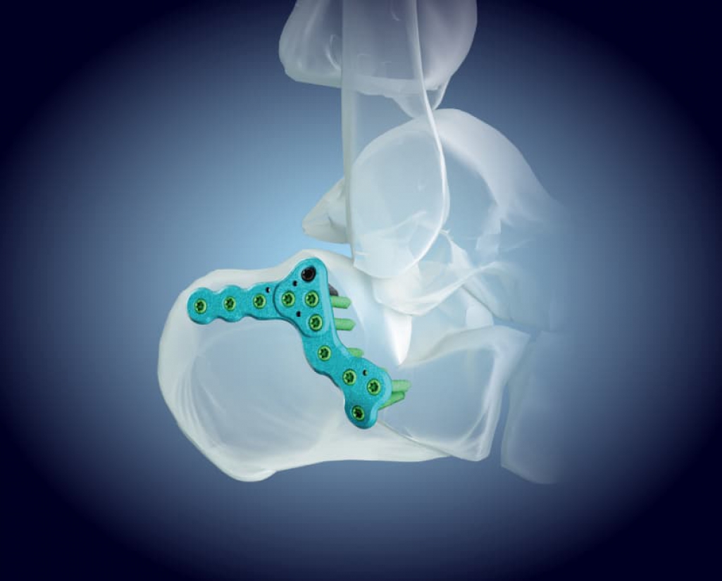 Ankle (O.A.L.P.A.S)