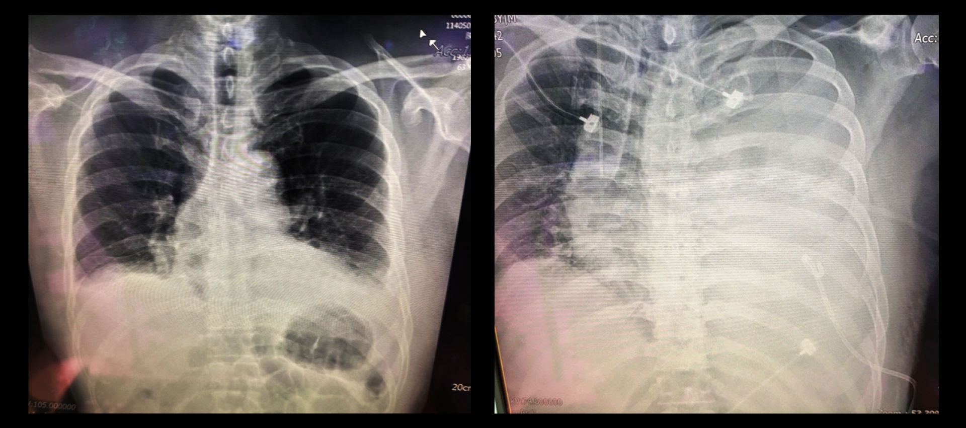 Cardinal Tien Hospital Case